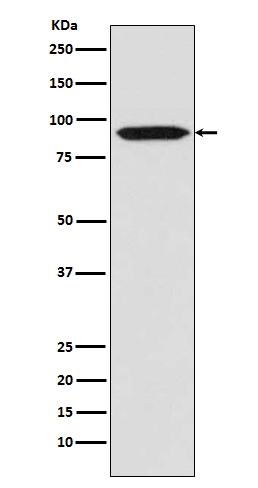 Bcl6 Rabbit mAb