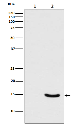 Phospho-alpha Synuclein (Ser129) Rabbit mAb