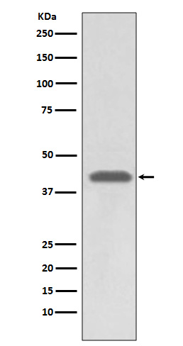 HLA A Rabbit mAb