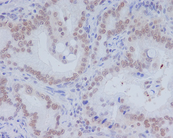 CD11b Rabbit mAb