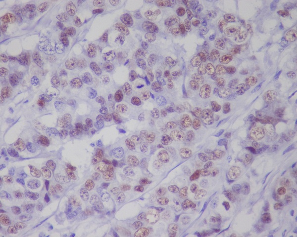 Phospho-p53 (Ser392) Rabbit mAb