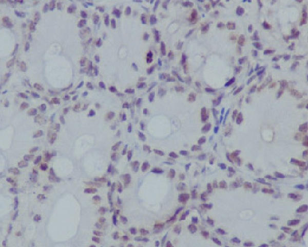 MonoMethyl-Histone H3 (Arg17) Rabbit mAb