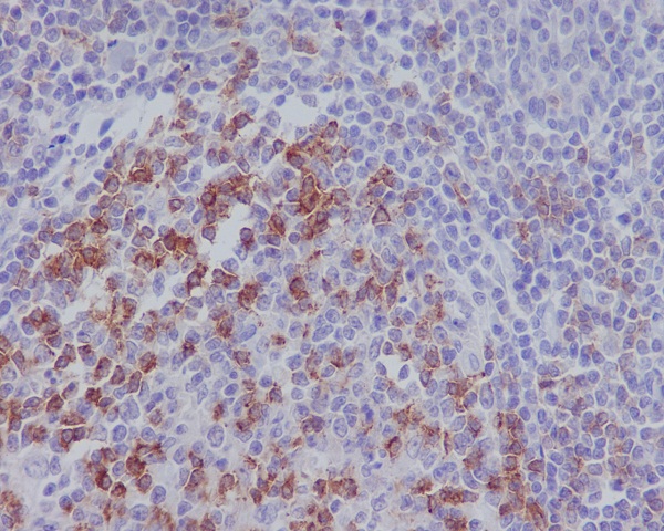 PD1 Rabbit mAb