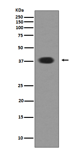 Musashi 1 Rabbit mAb