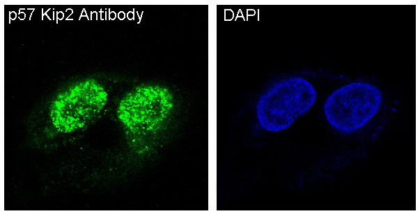 p57 Kip2 Rabbit mAb