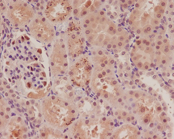 p57 Kip2 Rabbit mAb