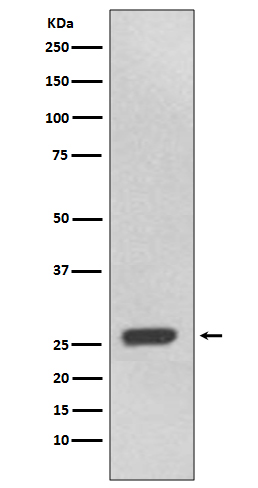 UCHL3 Rabbit mAb