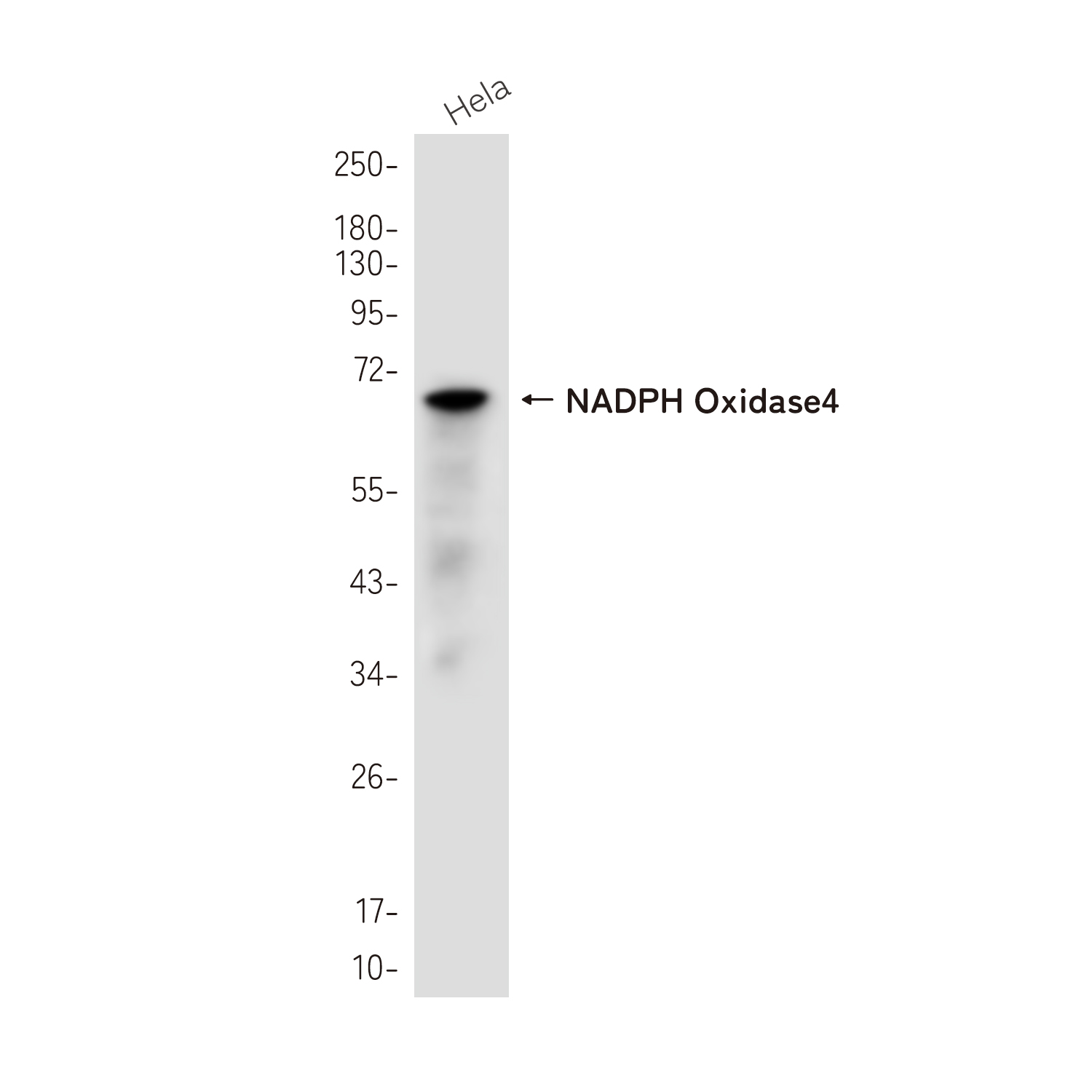 NADPH Oxidase 4 Rabbit mAb