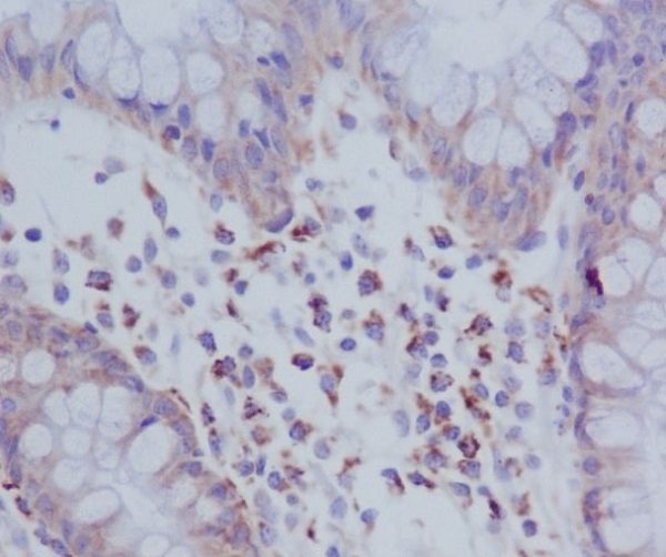 Phospho-PKR (Thr446) Rabbit mAb