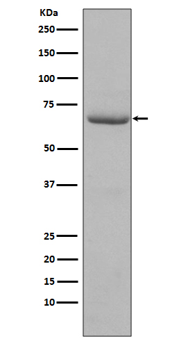 Phospho-PKR (Thr446) Rabbit mAb