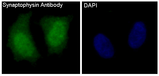 Synaptophysin Rabbit mAb