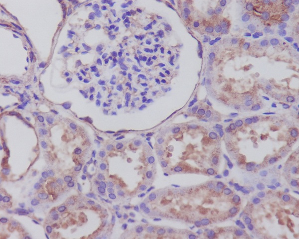 Synaptophysin Rabbit mAb