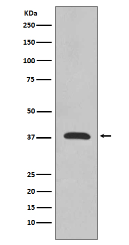 Synaptophysin Rabbit mAb