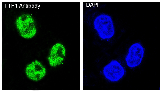 Thyroid Transcription Factor 1 Rabbit mAb