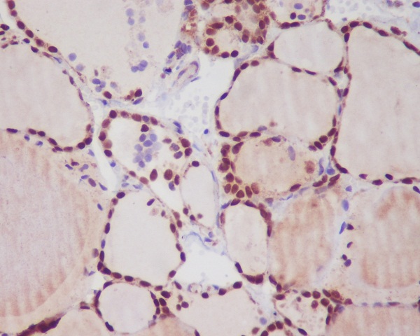 Thyroid Transcription Factor 1 Rabbit mAb