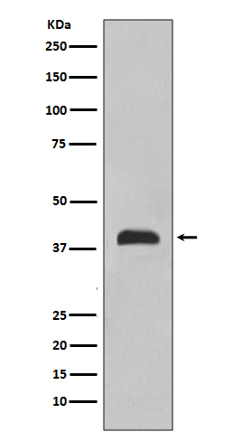 Thyroid Transcription Factor 1 Rabbit mAb