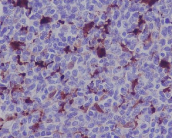 MERTK Rabbit mAb