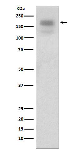 MERTK Rabbit mAb