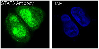 STAT3 Rabbit mAb