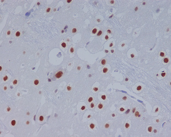 STAT3 Rabbit mAb