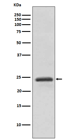 Rab11A Rabbit mAb