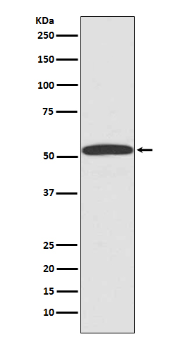 ARRB1 Rabbit mAb