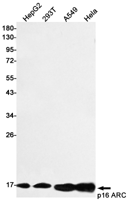 p16 ARC Rabbit mAb