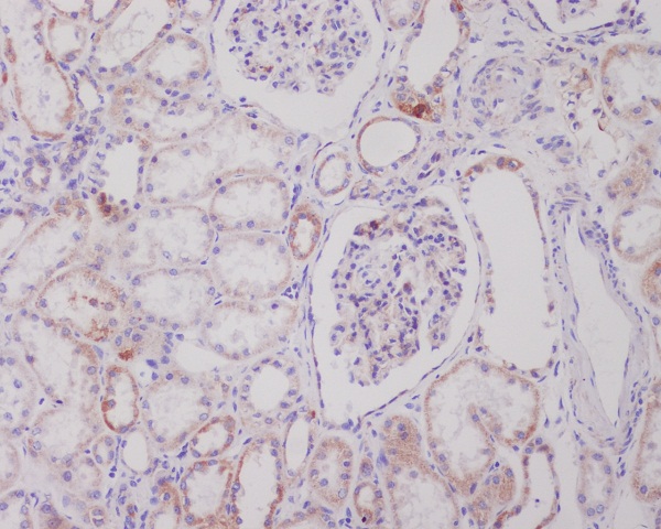 PI 3 Kinase p100 Rabbit mAb