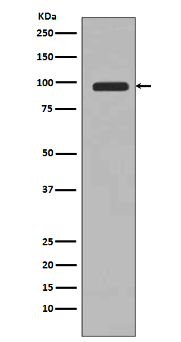 PI 3 Kinase p100 Rabbit mAb