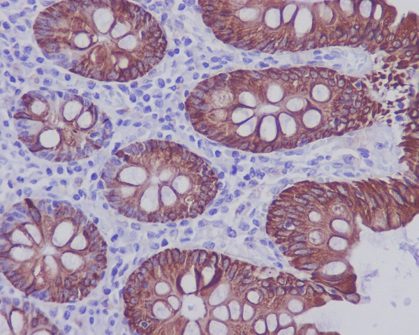 Cytokeratin 20 Rabbit mAb