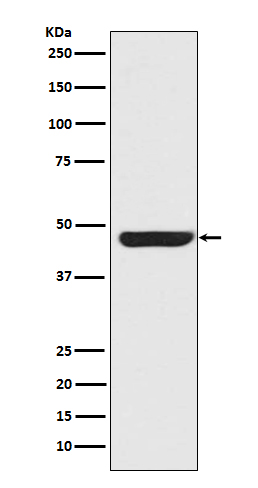 Cytokeratin 20 Rabbit mAb