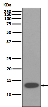 beta 2 Microglobulin Rabbit mAb