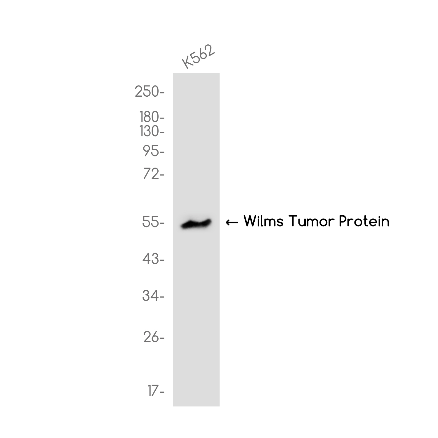 Wilms Tumor Protein Rabbit mAb