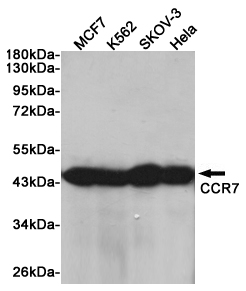 CCR7 Rabbit mAb