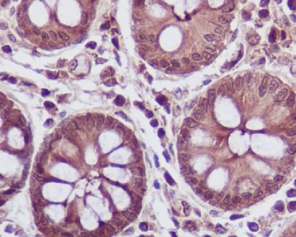 Lactate Dehydrogenase A Rabbit mAb