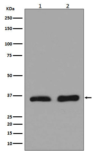 Lactate Dehydrogenase A Rabbit mAb