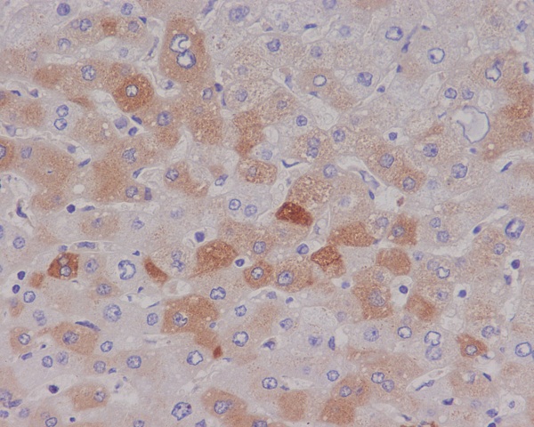 C Reactive Protein Rabbit mAb