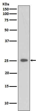 C Reactive Protein Rabbit mAb