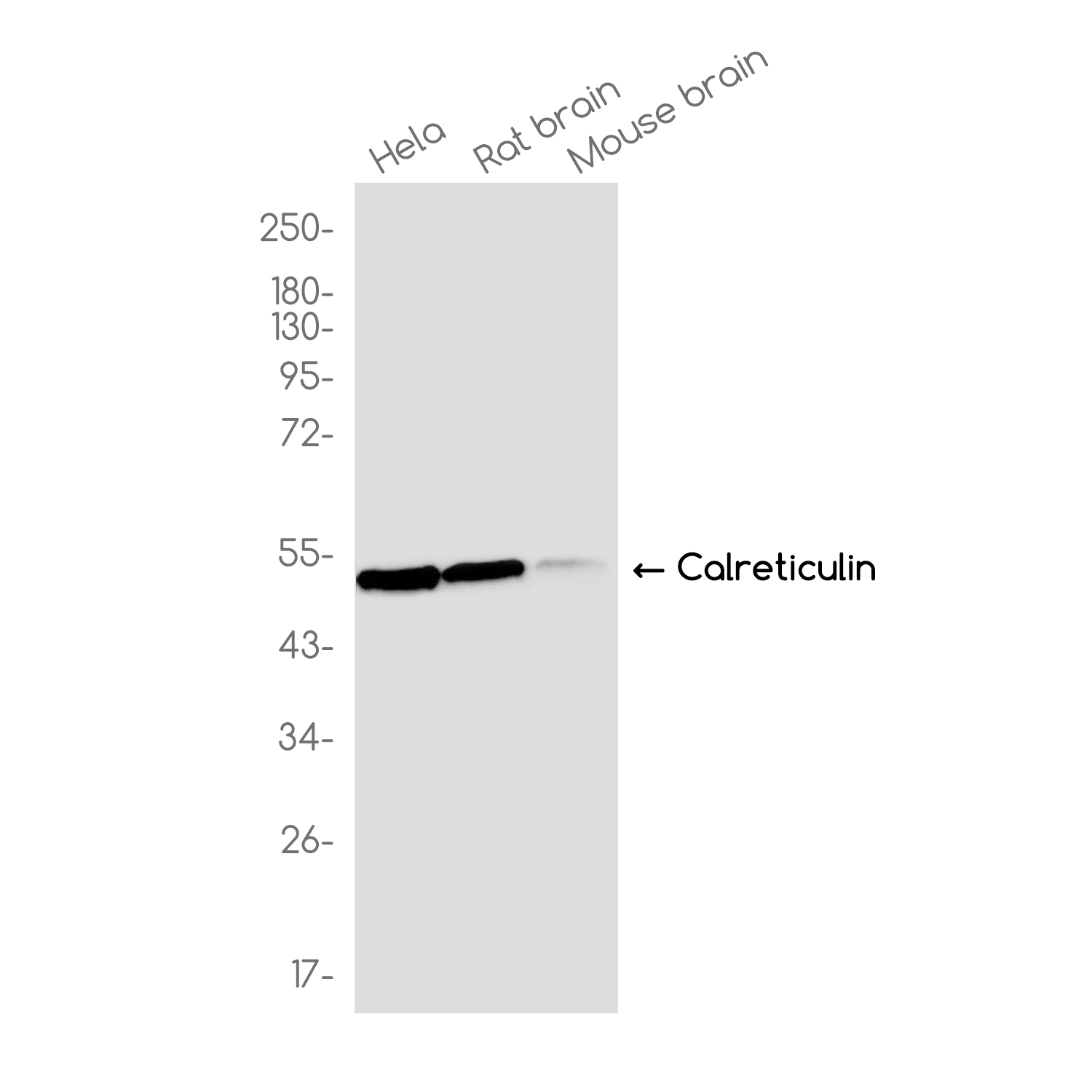 Calreticulin Rabbit mAb