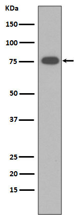 Vitronectin Rabbit mAb