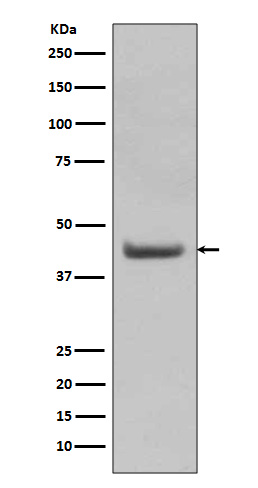 SOX18 Rabbit mAb