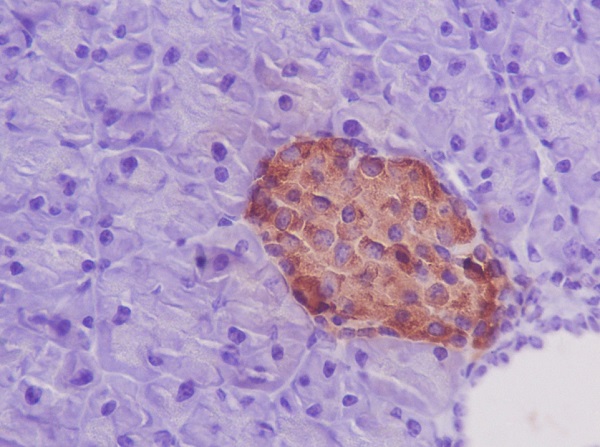 Insulin Rabbit mAb