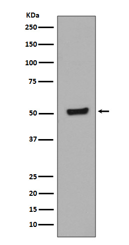 Phospho-p53 (Thr55) Rabbit mAb