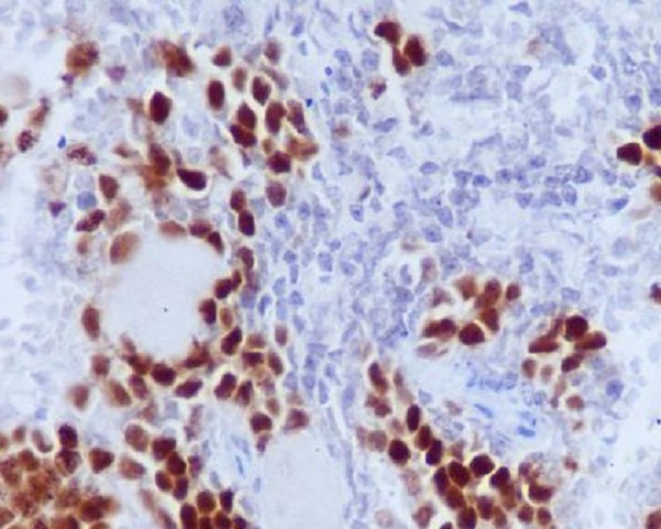 Phospho-Rb (Ser807) Rabbit mAb