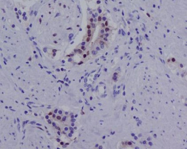 Androgen Receptor Rabbit mAb