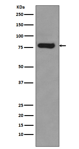 Androgen Receptor Rabbit mAb