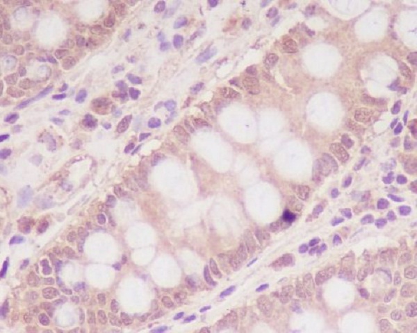 IGF2R Rabbit mAb