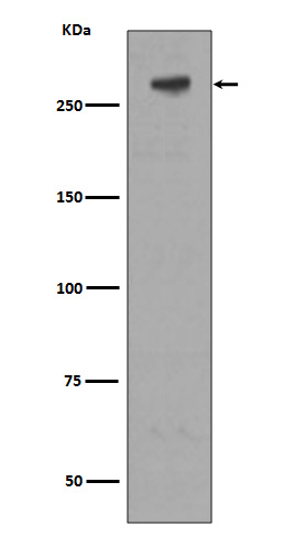 IGF2R Rabbit mAb