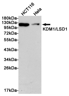 KDM1A Rabbit mAb