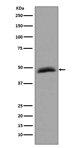 Aurora A Rabbit mAb